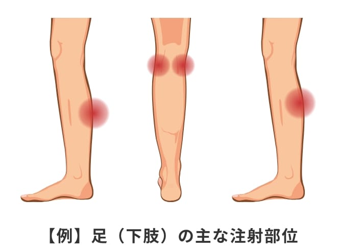 【例】足（下肢）の主な注射部位
